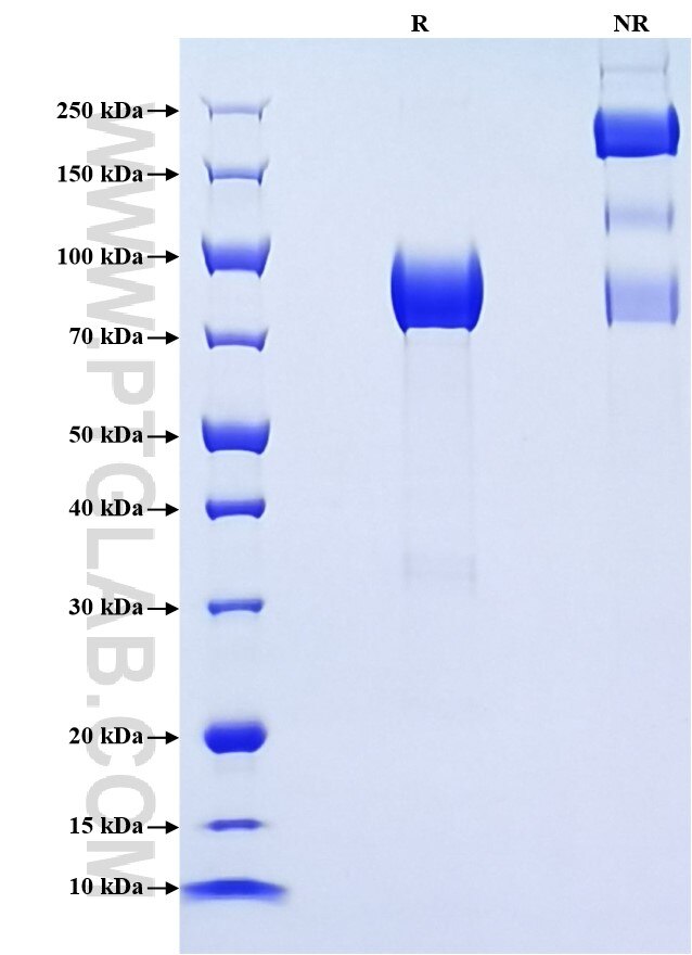 Purity of Recombinant Human Alpha 2-Antiplasmin was determined by SDS-PAGE. The protein was resolved in an SDS-PAGE in reducing (R) and non-reducing (NR) conditions and stained using Coomassie blue.