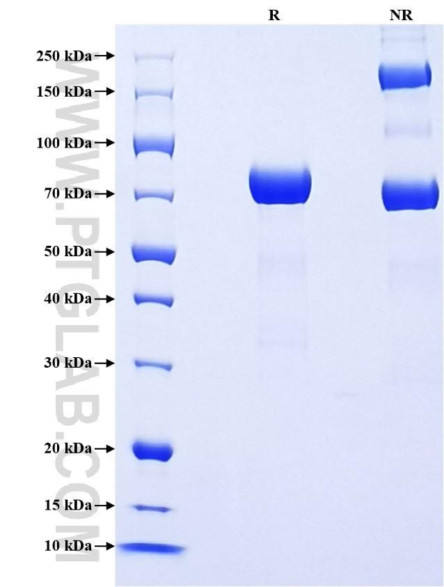 Purity of Recombinant Mouse Serpina1a was determined by SDS-PAGE. The protein was resolved in an SDS-PAGE in reducing (R) and non-reducing (NR) conditions and stained using Coomassie blue. Purity of Recombinant Mouse Serpina1a was determined by SDS-PAGE. The protein was resolved in an SDS-PAGE in reducing (R) and non-reducing (NR) conditions and stained using Coomassie blue.