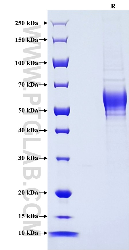 Purity of Recombinant Human CSN3 was determined by SDS-PAGE. The protein was resolved in an SDS-PAGE in reducing (R) conditions and stained using Coomassie blue. Purity of Recombinant Human CSN3 was determined by SDS-PAGE. The protein was resolved in an SDS-PAGE in reducing (R) conditions and stained using Coomassie blue.