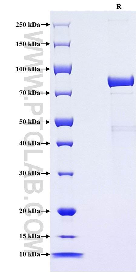 Purity of Recombinant Human PDI was determined by SDS-PAGE. The protein was resolved in an SDS-PAGE in reducing (R) conditions and stained using Coomassie blue. Purity of Recombinant Human PDI was determined by SDS-PAGE. The protein was resolved in an SDS-PAGE in reducing (R) conditions and stained using Coomassie blue.