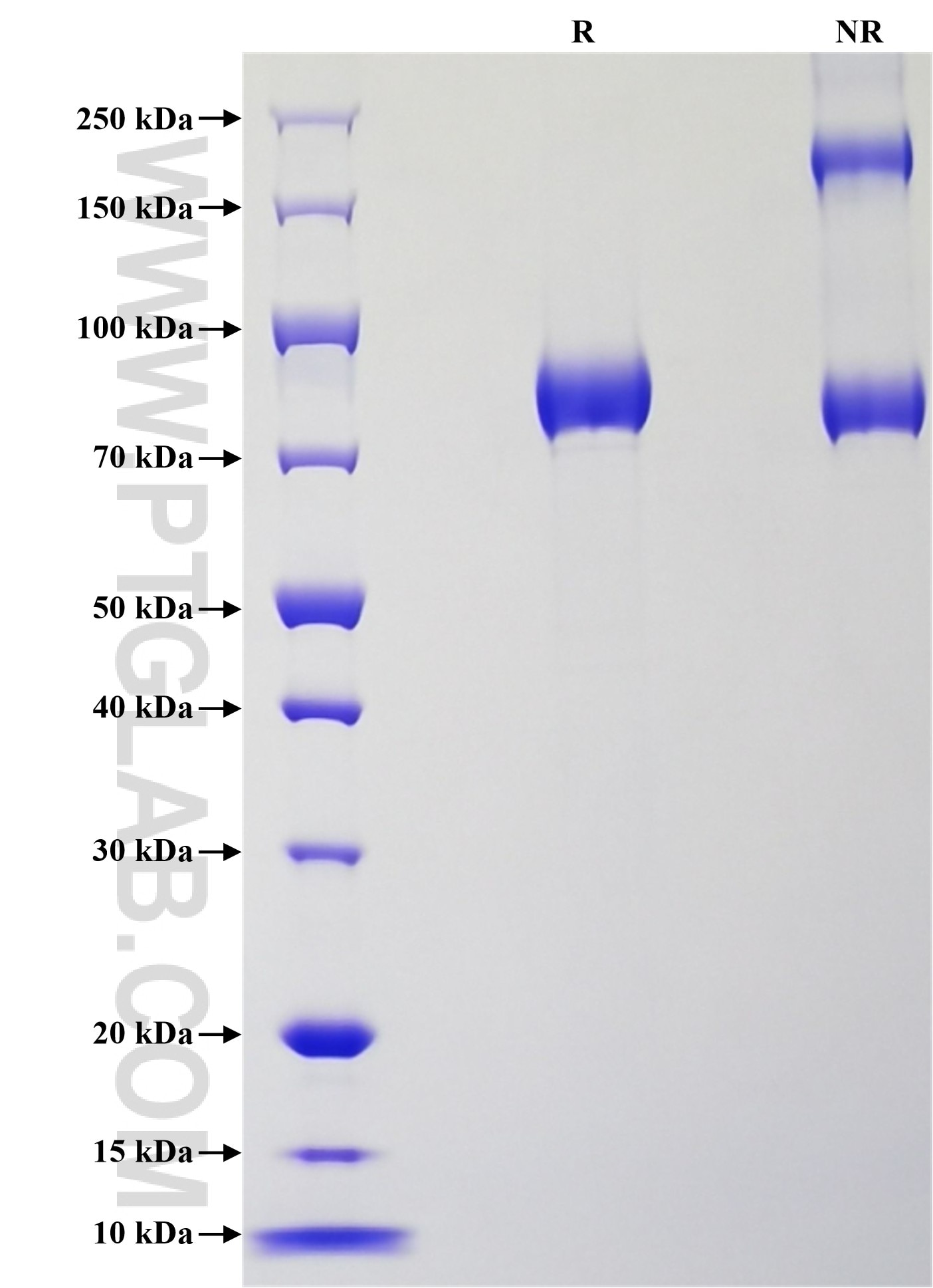 Purity of Recombinant Human SERPINA7 was determined by SDS-PAGE. The protein was resolved in an SDS-PAGE in reducing (R) and non-reducing (NR) conditions and stained using Coomassie blue.