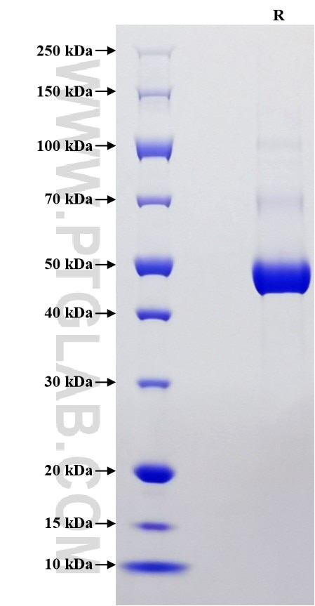 Purity of Recombinant Human Tetranectin was determined by SDS-PAGE. The protein was resolved in an SDS-PAGE in reducing (R) conditions and stained using Coomassie blue.
