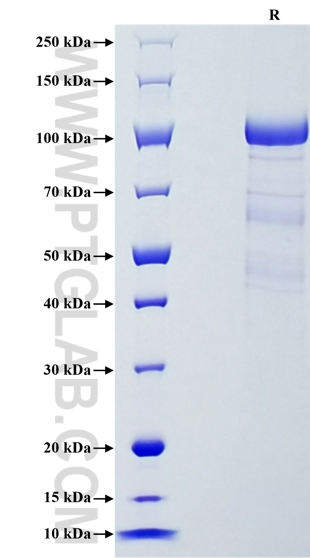Purity of Recombinant Human Complement Factor I was determined by SDS-PAGE. The protein was resolved in an SDS-PAGE in reducing (R)  conditions and stained using Coomassie blue.
