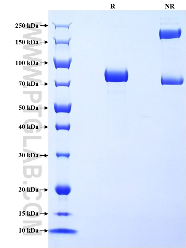 Purity of Recombinant Human Pancreatic alpha-amylase 
was determined by SDS-PAGE. The protein was resolved in an SDS-PAGE in reducing (R) and non-reducing (NR) conditions and stained using Coomassie blue.