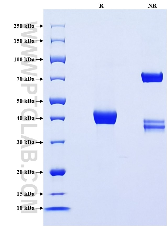 Purity of Recombinant Human PLA2G1B was determined by SDS-PAGE. The protein was resolved in an SDS-PAGE in reducing (R) and non-reducing (NR) conditions and stained using Coomassie blue. Purity of Recombinant Human PLA2G1B was determined by SDS-PAGE. The protein was resolved in an SDS-PAGE in reducing (R) and non-reducing (NR) conditions and stained using Coomassie blue.