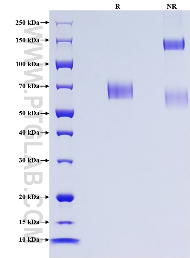 Purity of Recombinant Mouse Cfd was determined by SDS-PAGE. The protein was resolved in an SDS-PAGE in reducing (R) and non-reducing (NR) conditions and stained using Coomassie blue. Purity of Recombinant Mouse Cfd was determined by SDS-PAGE. The protein was resolved in an SDS-PAGE in reducing (R) and non-reducing (NR) conditions and stained using Coomassie blue.