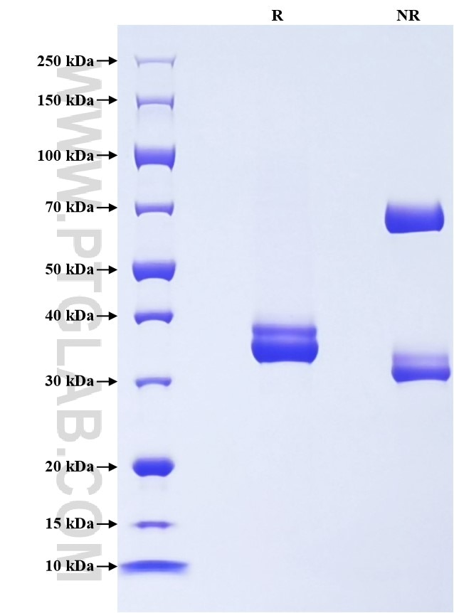 Purity of Recombinant Human SMR3B was determined by SDS-PAGE. The protein was resolved in an SDS-PAGE in reducing (R) and non-reducing (NR) conditions and stained using Coomassie blue.