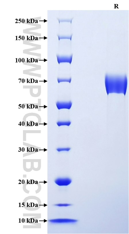 Purity of Recombinant Human LRG1 was determined by SDS-PAGE. The protein was resolved in an SDS-PAGE in reducing (R) conditions and stained using Coomassie blue.