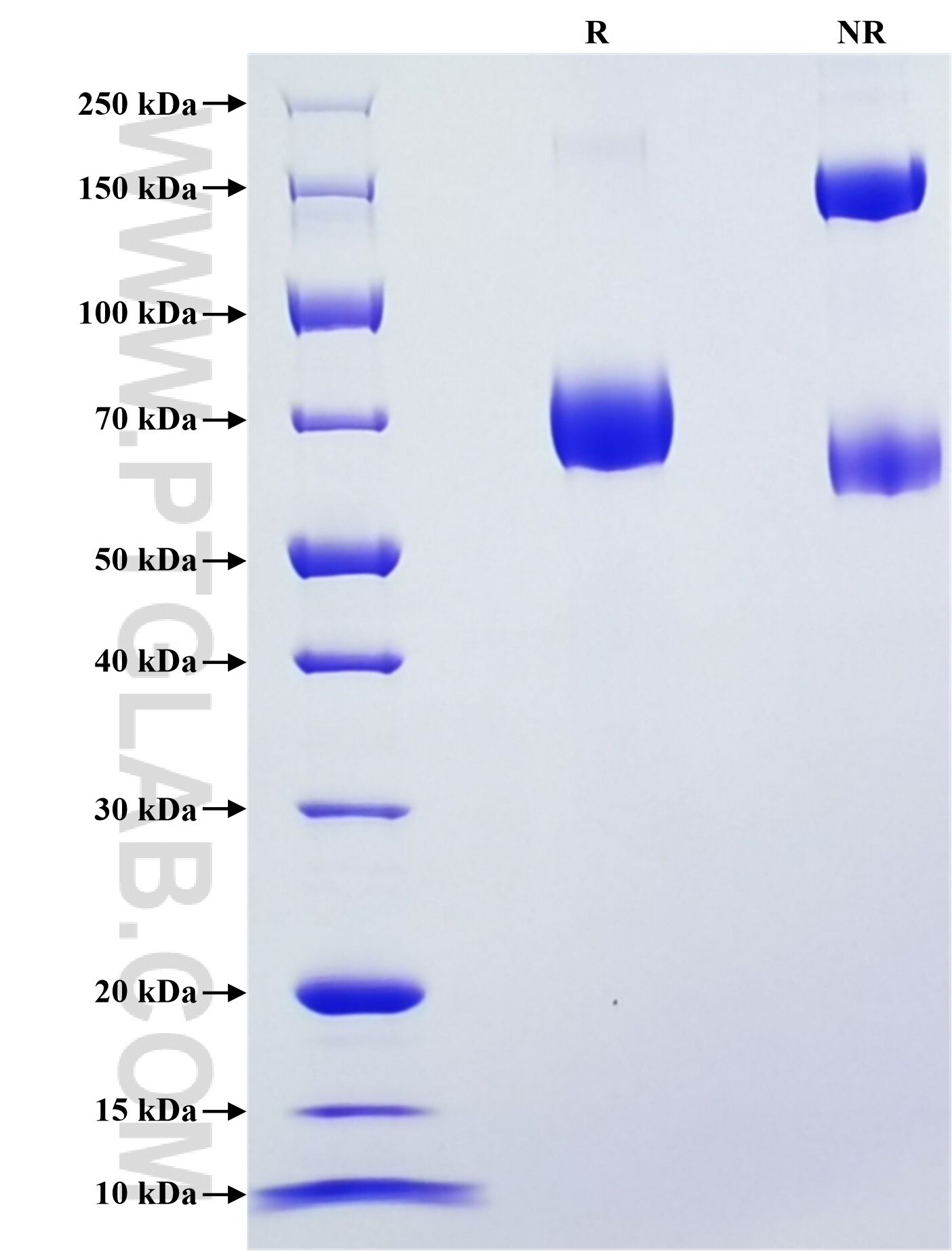 Purity of Recombinant Human APOH was determined by SDS-PAGE. The protein was resolved in an SDS-PAGE in reducing (R) and non-reducing (NR) conditions and stained using Coomassie blue.