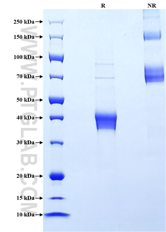 Purity of Recombinant Human Apolipoprotein A II was determined by SDS-PAGE. The protein was resolved in an SDS-PAGE in reducing (R) and non-reducing (NR) conditions and stained using Coomassie blue.