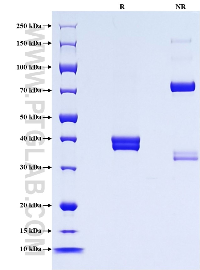 Purity of Recombinant Mouse Beta-2-Microglobulin was determined by SDS-PAGE. The protein was resolved in an SDS-PAGE in reducing (R) and non-reducing (NR) conditions and stained using Coomassie blue.