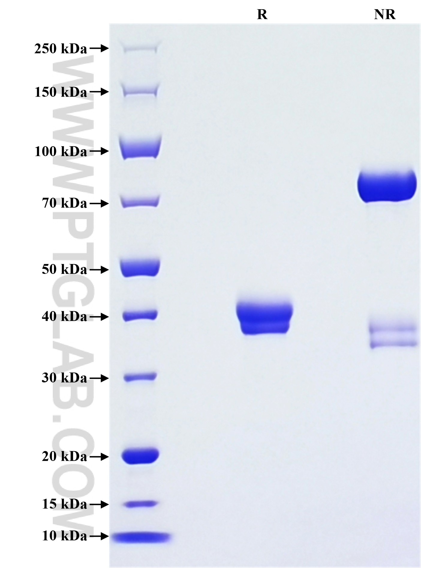 Purity of Recombinant Human Gastrin was determined by SDS-PAGE. The protein was resolved in an SDS-PAGE in reducing (R) and non-reducing (NR) conditions and stained using Coomassie blue.