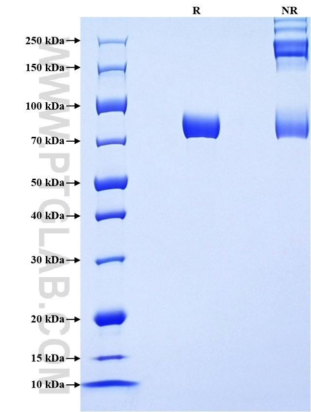 Purity of Recombinant Human Angiotensinogen was determined by SDS-PAGE. The protein was resolved in an SDS-PAGE in reducing (R) and non-reducing (NR) conditions and stained using Coomassie blue. Purity of Recombinant Human Angiotensinogen was determined by SDS-PAGE. The protein was resolved in an SDS-PAGE in reducing (R) and non-reducing (NR) conditions and stained using Coomassie blue.