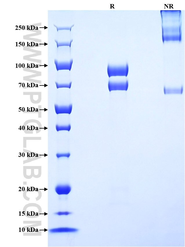 Purity of Recombinant Human NPTXR was determined by SDS-PAGE. The protein was resolved in an SDS-PAGE in reducing (R) and non-reducing (NR) conditions and stained using Coomassie blue.