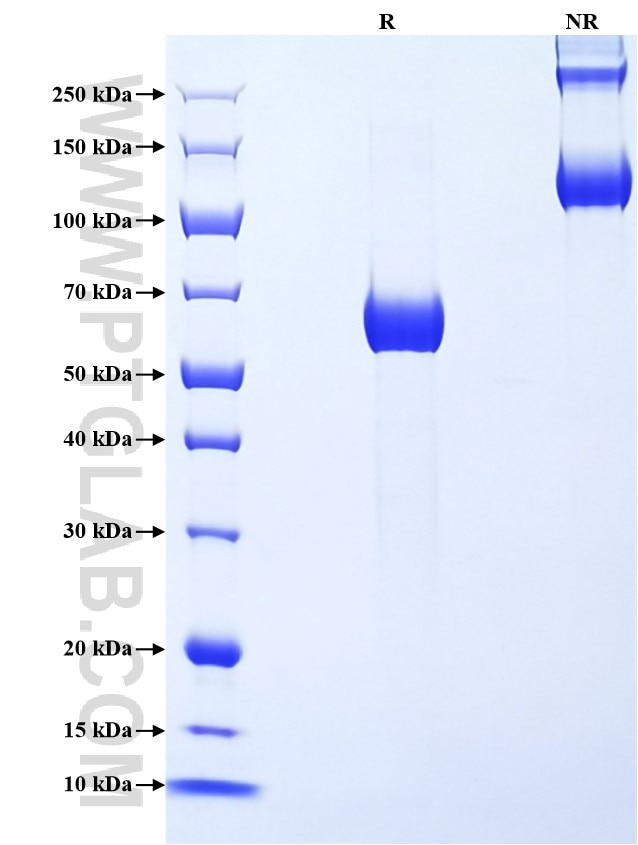 Purity of Recombinant Human Stanniocalcin 2 was determined by SDS-PAGE. The protein was resolved in an SDS-PAGE in reducing (R) and non-reducing (NR) conditions and stained using Coomassie blue.