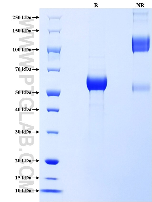 Purity of Recombinant Human PGLYRP1 was determined by SDS-PAGE. The protein was resolved in an SDS-PAGE in reducing (R) and non-reducing (NR) conditions and stained using Coomassie blue.