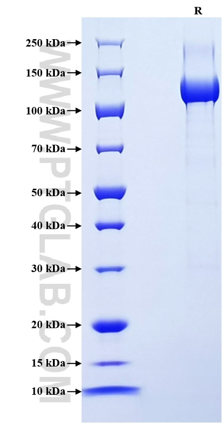 Purity of Recombinant Human Neuropilin 2 was determined by SDS-PAGE. The protein was resolved in an SDS-PAGE in reducing (R) conditions and stained using Coomassie blue.