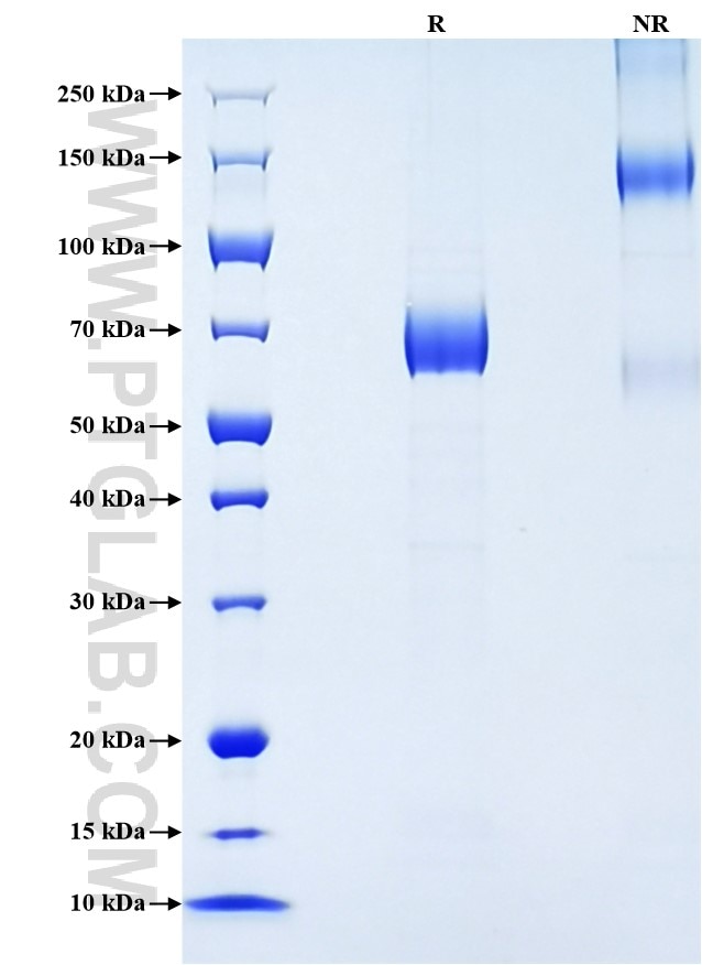 Purity of Recombinant Mouse TFPI was determined by SDS-PAGE. The protein was resolved in an SDS-PAGE in reducing (R) and non-reducing (NR) conditions and stained using Coomassie blue.