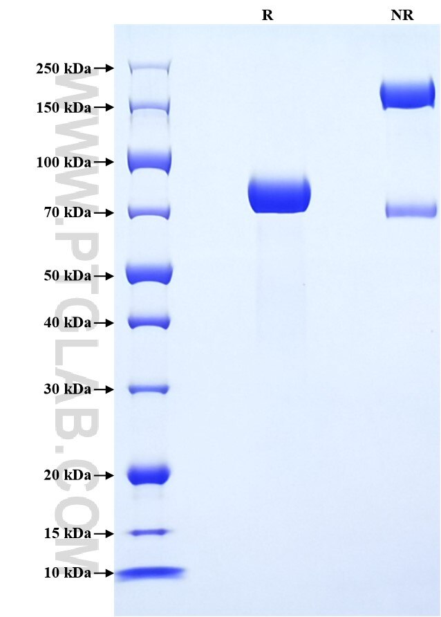 Purity of Recombinant Human SPINT1 was determined by SDS-PAGE. The protein was resolved in an SDS-PAGE in reducing (R) and non-reducing (NR) conditions and stained using Coomassie blue.