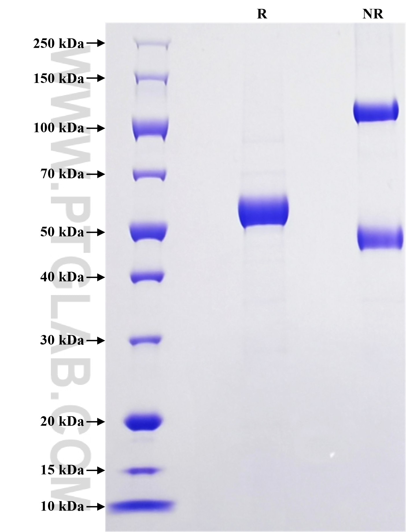 Purity of Recombinant HHuman Kallikrein 10 was determined by SDS-PAGE. The protein was resolved in an SDS-PAGE in reducing (R) and non-reducing (NR) conditions and stained using Coomassie blue. Purity of Recombinant HHuman Kallikrein 10 was determined by SDS-PAGE. The protein was resolved in an SDS-PAGE in reducing (R) and non-reducing (NR) conditions and stained using Coomassie blue.