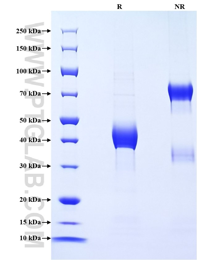 Purity of Recombinant Human CCL16 was determined by SDS-PAGE. The protein was resolved in an SDS-PAGE in reducing (R) and non-reducing (NR) conditions and stained using Coomassie blue.