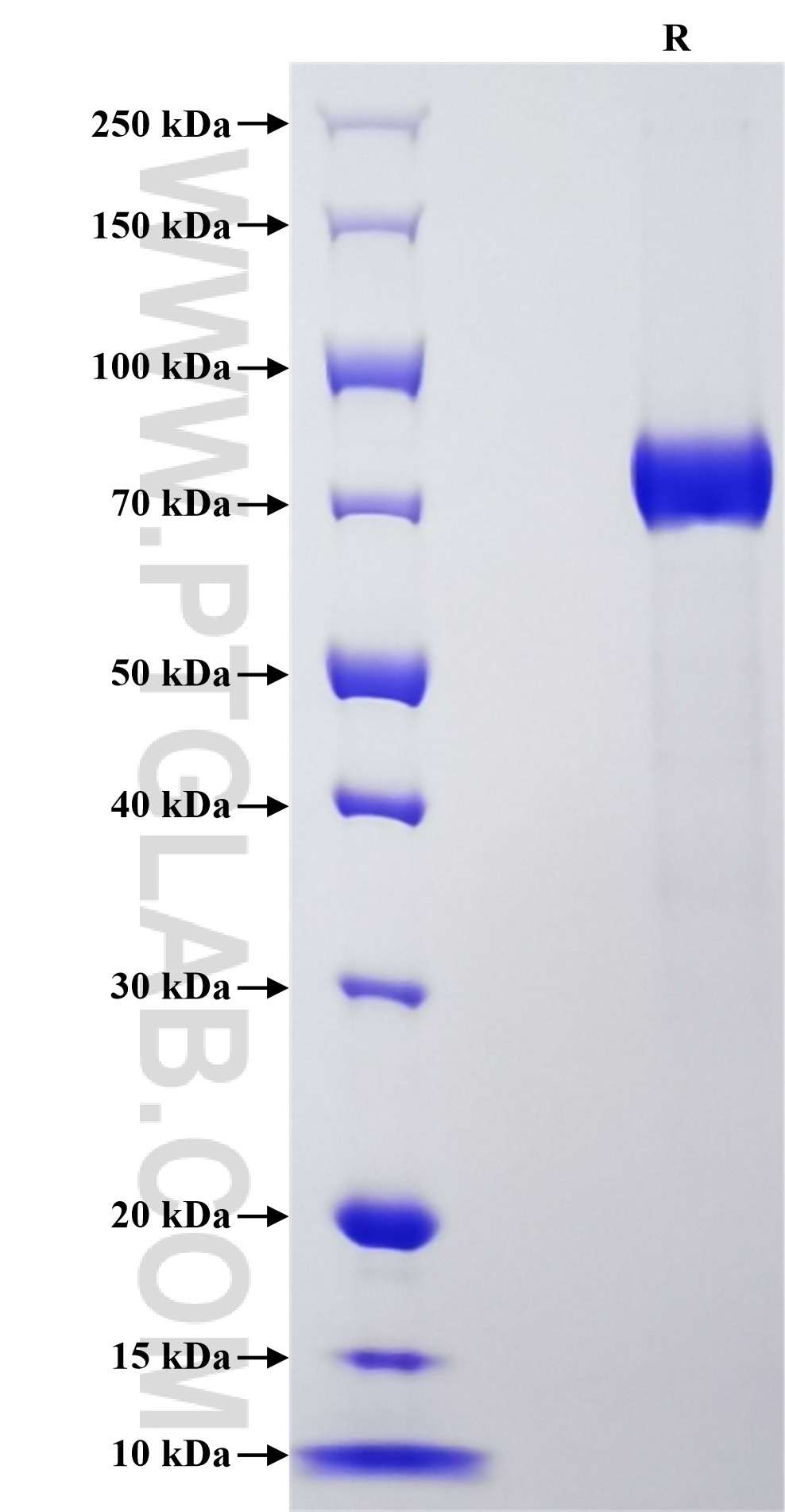 Purity of Recombinant Human MATN3 was determined by SDS-PAGE. The protein was resolved in an SDS-PAGE in reducing (R) conditions and stained using Coomassie blue. Purity of Recombinant Human MATN3 was determined by SDS-PAGE. The protein was resolved in an SDS-PAGE in reducing (R) conditions and stained using Coomassie blue.