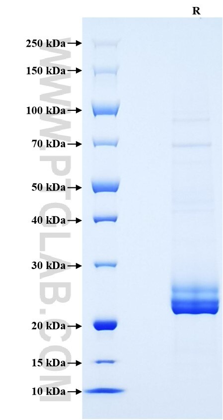 Purity of Recombinant Mouse TNF-alpha was determined by SDS-PAGE. The protein was resolved in an SDS-PAGE in reducing (R) conditions and stained using Coomassie blue.