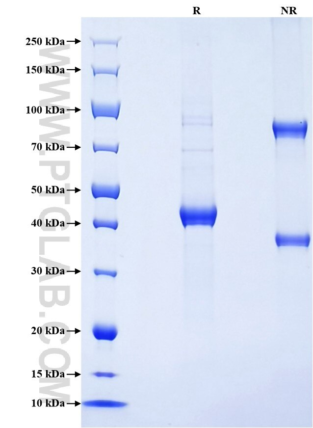 Purity of Recombinant Human LECT2 was determined by SDS-PAGE. The protein was resolved in an SDS-PAGE in reducing (R) and non-reducing (NR) conditions and stained using Coomassie blue.