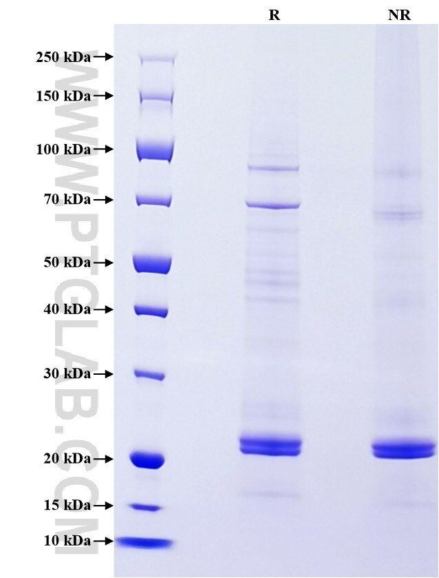Purity of Recombinant Rat TNF-alpha was determined by SDS-PAGE. The protein was resolved in an SDS-PAGE in reducing (R) and non-reducing (NR) conditions and stained using Coomassie blue. Purity of Recombinant Rat TNF-alpha was determined by SDS-PAGE. The protein was resolved in an SDS-PAGE in reducing (R) and non-reducing (NR) conditions and stained using Coomassie blue.