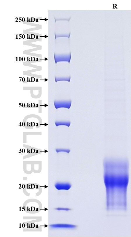 Purity of Recombinant Human MCP-1 was determined by SDS-PAGE. The protein was resolved in an SDS-PAGE in reducing (R) conditions and stained using Coomassie blue.