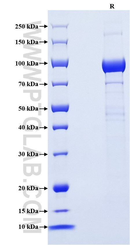 Purity of Recombinant Mouse PSAP  was determined by SDS-PAGE. The protein was resolved in an SDS-PAGE in reducing (R) conditions and stained using Coomassie blue.