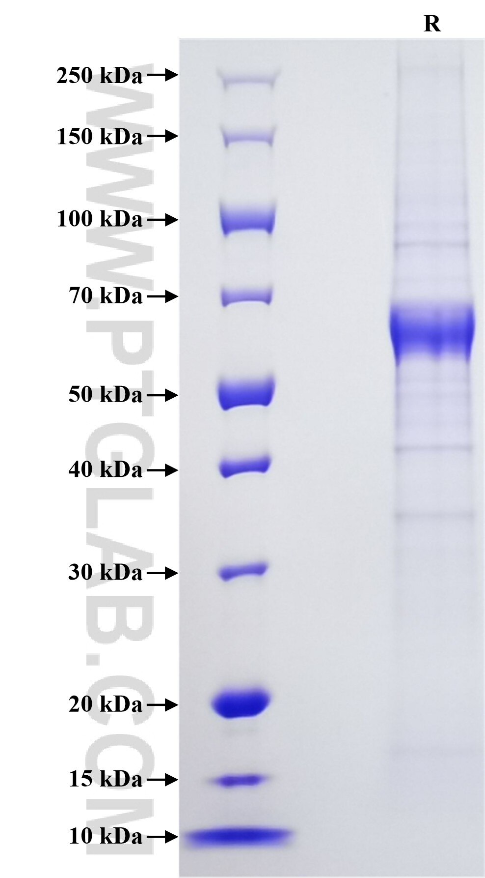 Purity of Recombinant Human LAG-3 was determined by SDS-PAGE. The protein was resolved in an SDS-PAGE in reducing (R) conditions and stained using Coomassie blue. Purity of Recombinant Human LAG-3 was determined by SDS-PAGE. The protein was resolved in an SDS-PAGE in reducing (R) conditions and stained using Coomassie blue.