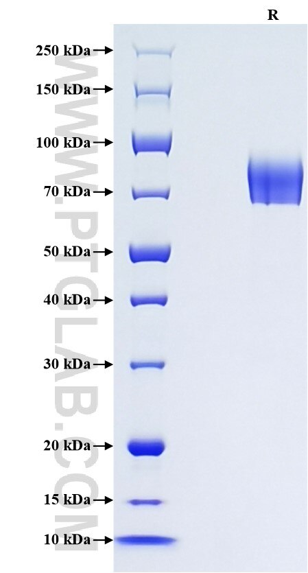 Purity of Recombinant Mouse uPAR was determined by SDS-PAGE. The protein was resolved in an SDS-PAGE in reducing (R) conditions and stained using Coomassie blue.