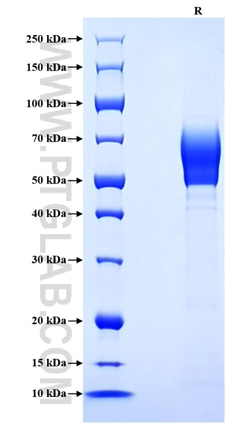 Purity of Recombinant Mouse IL18BP was determined by SDS-PAGE. The protein was resolved in an SDS-PAGE in reducing (R) conditions and stained using Coomassie blue. Purity of Recombinant Mouse IL18BP was determined by SDS-PAGE. The protein was resolved in an SDS-PAGE in reducing (R) conditions and stained using Coomassie blue.