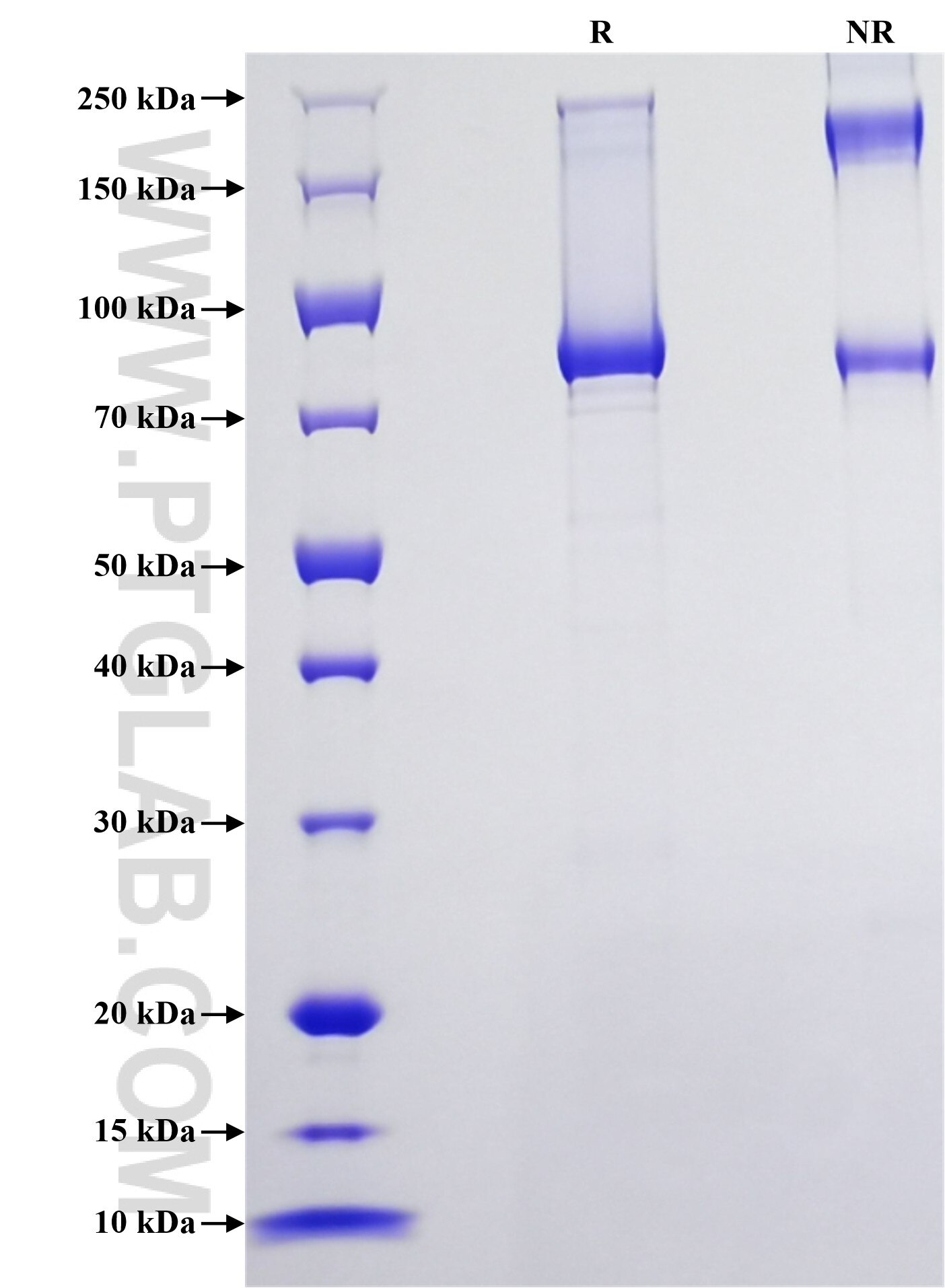 Purity of Recombinant Mouse MMP8 was determined by SDS-PAGE. The protein was resolved in an SDS-PAGE in reducing (R) and non-reducing (NR) conditions and stained using Coomassie blue.