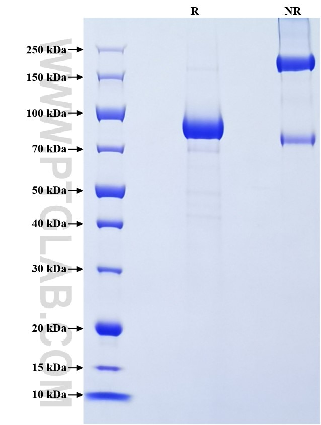 Purity of Recombinant Mouse LBP was determined by SDS-PAGE. The protein was resolved in an SDS-PAGE in reducing (R) and non-reducing (NR) conditions and stained using Coomassie blue. Purity of Recombinant Mouse LBP was determined by SDS-PAGE. The protein was resolved in an SDS-PAGE in reducing (R) and non-reducing (NR) conditions and stained using Coomassie blue.
