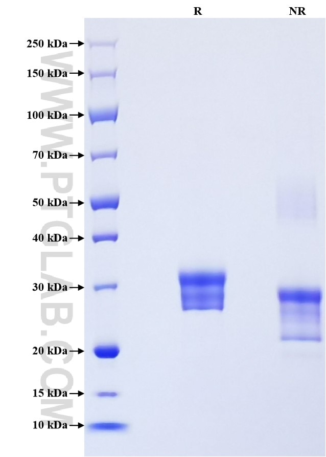 Purity of Recombinant Human RBP4 was determined by SDS-PAGE. The protein was resolved in an SDS-PAGE in reducing (R) and non-reducing (NR) conditions and stained using Coomassie blue.