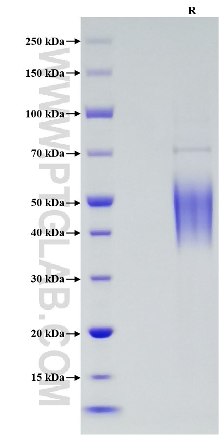 Purity of Recombinant Human FCGR3A (F176V) was determined by SDS-PAGE. The protein was resolved in an SDS-PAGE in reducing (R) conditions and stained using Coomassie blue.