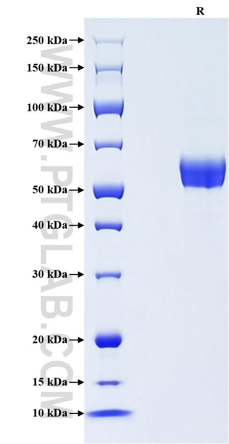 Purity of Recombinant Mouse IL-20RB was determined by SDS-PAGE. The protein was resolved in an SDS-PAGE in reducing (R) conditions and stained using Coomassie blue. Purity of Recombinant Mouse IL-20RB was determined by SDS-PAGE. The protein was resolved in an SDS-PAGE in reducing (R) conditions and stained using Coomassie blue.