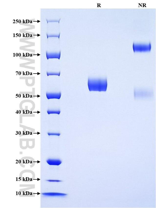Purity of Recombinant Human FOLR3 was determined by SDS-PAGE. The protein was resolved in an SDS-PAGE in reducing (R) and non-reducing (NR) conditions and stained using Coomassie blue. Purity of Recombinant Human FOLR3 was determined by SDS-PAGE. The protein was resolved in an SDS-PAGE in reducing (R) and non-reducing (NR) conditions and stained using Coomassie blue.