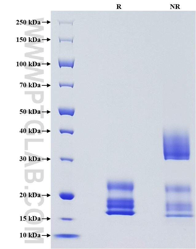 Purity of Recombinant Human Beta-2-Microglobulin was determined by SDS-PAGE. The protein was resolved in an SDS-PAGE in reducing (R) and non-reducing (NR) conditions and stained using Coomassie blue.