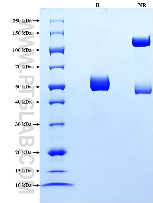 Purity of Recombinant Human Neutrophil Elastase was determined by SDS-PAGE. The protein was resolved in an SDS-PAGE in reducing (R) and non-reducing (NR) conditions and stained using Coomassie blue.