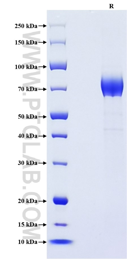 Purity of Recombinant Mouse CD19 was determined by SDS-PAGE. The protein was resolved in an SDS-PAGE in reducing (R) conditions and stained using Coomassie blue.