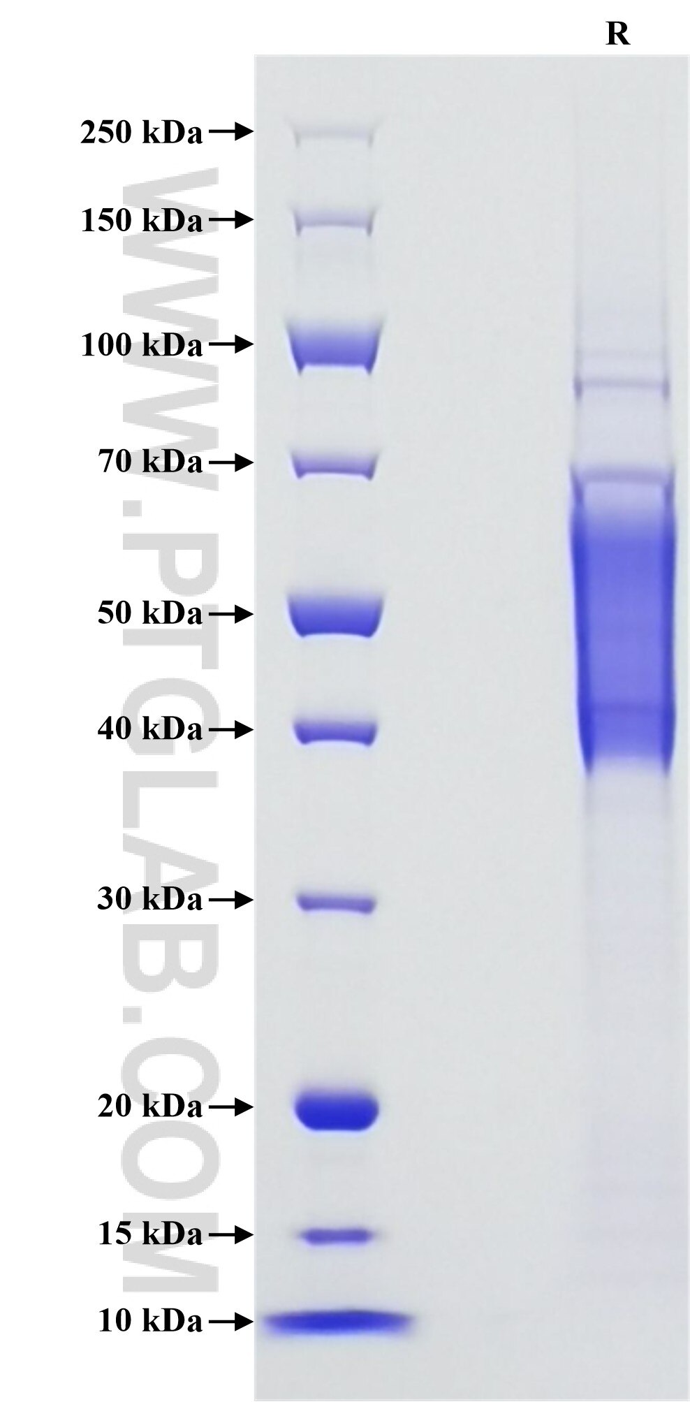 Purity of Recombinant Human CD244 was determined by SDS-PAGE. The protein was resolved in an SDS-PAGE in reducing (R) and non-reducing (NR) conditions and stained using Coomassie blue.