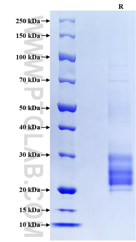 Purity of Recombinant Human TNFSF18 was determined by SDS-PAGE. The protein was resolved in an SDS-PAGE in reducing (R) conditions and stained using Coomassie blue. Purity of Recombinant Human TNFSF18 was determined by SDS-PAGE. The protein was resolved in an SDS-PAGE in reducing (R) conditions and stained using Coomassie blue.