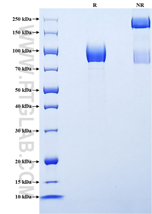 Purity of Recombinant Rat TrkA was determined by SDS-PAGE. The protein was resolved in an SDS-PAGE in reducing (R) and non-reducing (NR) conditions and stained using Coomassie blue. Purity of Recombinant Rat TrkA was determined by SDS-PAGE. The protein was resolved in an SDS-PAGE in reducing (R) and non-reducing (NR) conditions and stained using Coomassie blue.