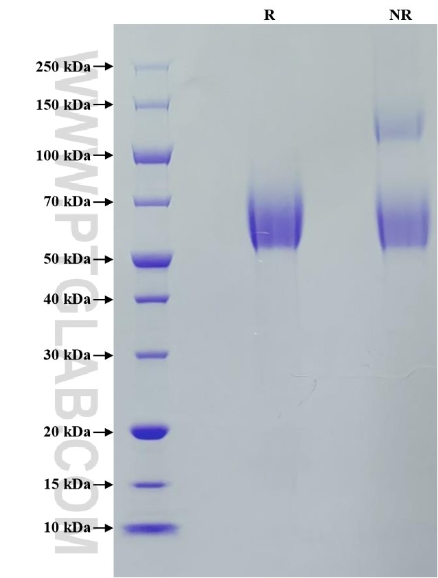 Purity of Recombinant Human CEACAM-8 was determined by SDS-PAGE. The protein was resolved in an SDS-PAGE in reducing (R) and non-reducing (NR) conditions and stained using Coomassie blue.