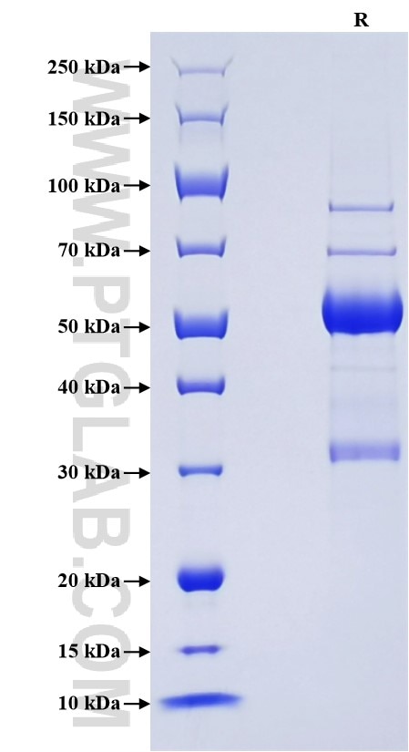 Purity of Recombinant Rat Fas Ligand was determined by SDS-PAGE. The protein was resolved in an SDS-PAGE in reducing (R) conditions and stained using Coomassie blue. Purity of Recombinant Rat Fas Ligand was determined by SDS-PAGE. The protein was resolved in an SDS-PAGE in reducing (R) conditions and stained using Coomassie blue.