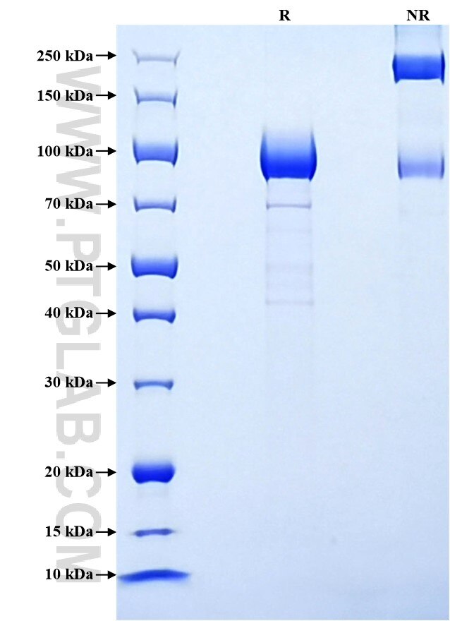 Purity of Recombinant Rat CD36 was determined by SDS-PAGE. The protein was resolved in an SDS-PAGE in reducing (R) and non-reducing (NR) conditions and stained using Coomassie blue.