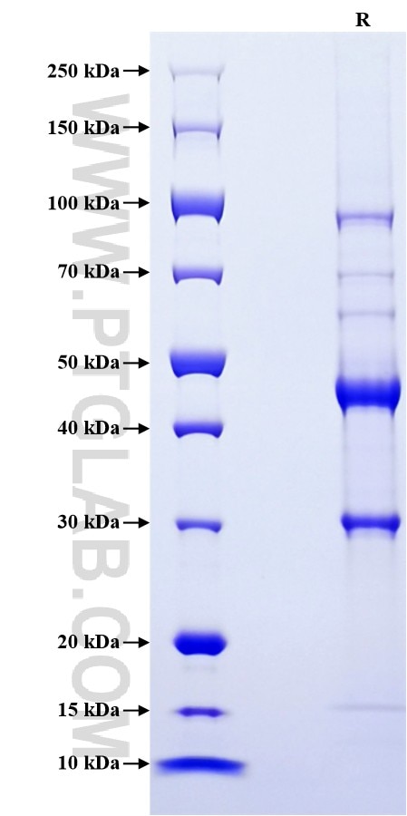 Purity of Recombinant Human IL-32 was determined by SDS-PAGE. The protein was resolved in an SDS-PAGE in reducing (R) conditions and stained using Coomassie blue. Purity of Recombinant Human IL-32 was determined by SDS-PAGE. The protein was resolved in an SDS-PAGE in reducing (R) conditions and stained using Coomassie blue.